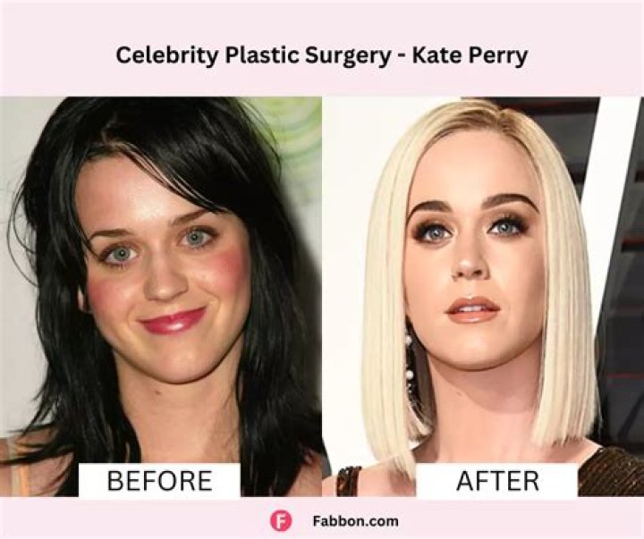 13 Celebrities Who Had Plastic Surgery and Don't Regret it — Celebwell