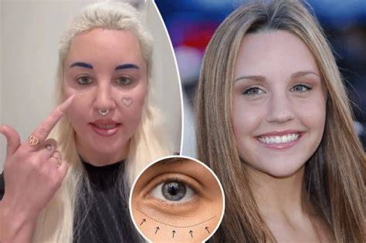 Amanda Bynes reveals she’s in the process of getting her heart face tattoo removed