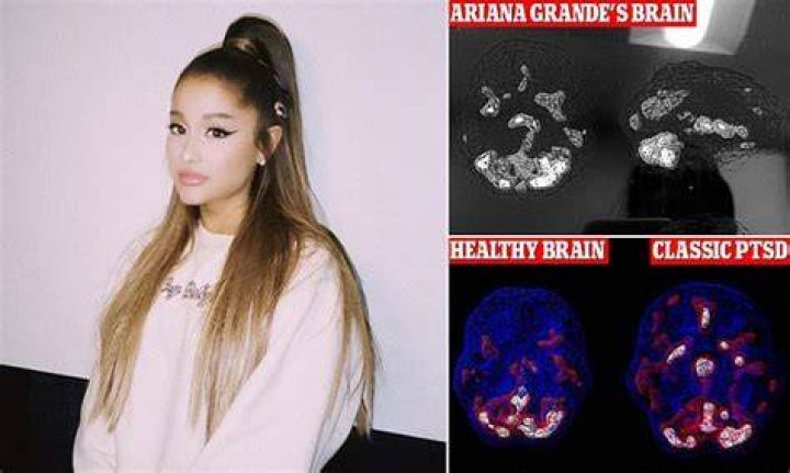 Ariana Grande Reveals Her Terrifying Levels Of PTSD By Posting Brain Scan