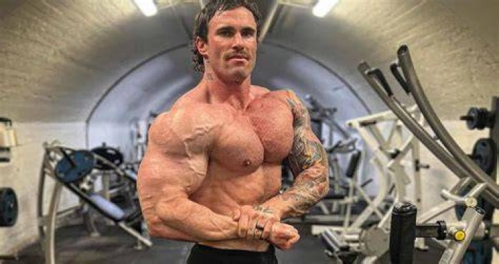 Bodybuilder Calum Von Moger in hospital pictures