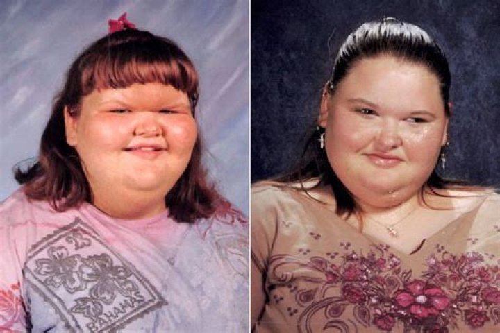 Did One Of The 600 Pound Sisters Died? – Celebrity