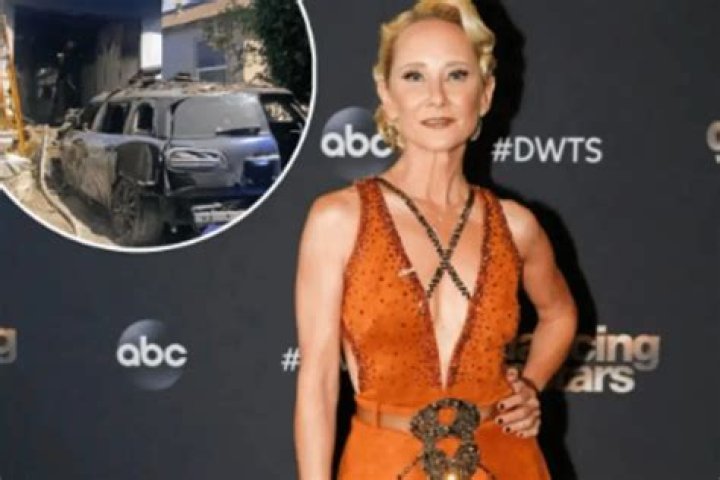 Due To Thermal Wounds And Smoke Inhalation, Anne Heche Passed Away