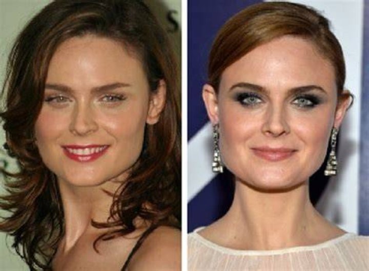 Emily Deschanel Plastic Surgery Before and After