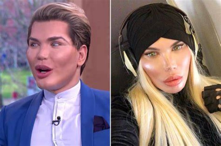 Human Ken Doll Rodrigo Alves Comes Out As Transgender Woman — From Ken To Barbie
