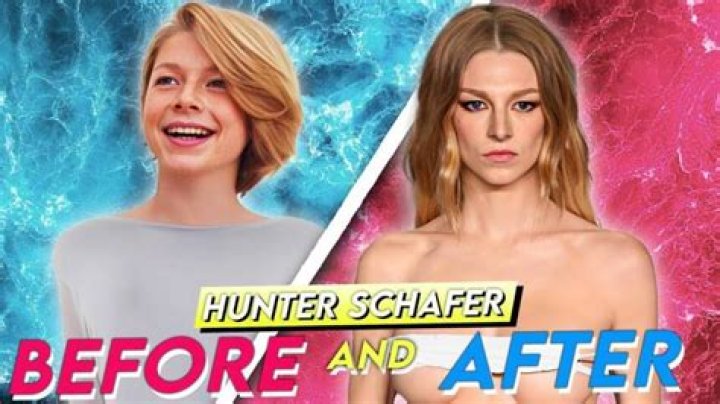 Hunter Schafer before and after surgery pictures