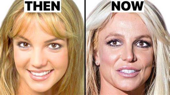 Is Britney Spears In Danger Of Going Bald?