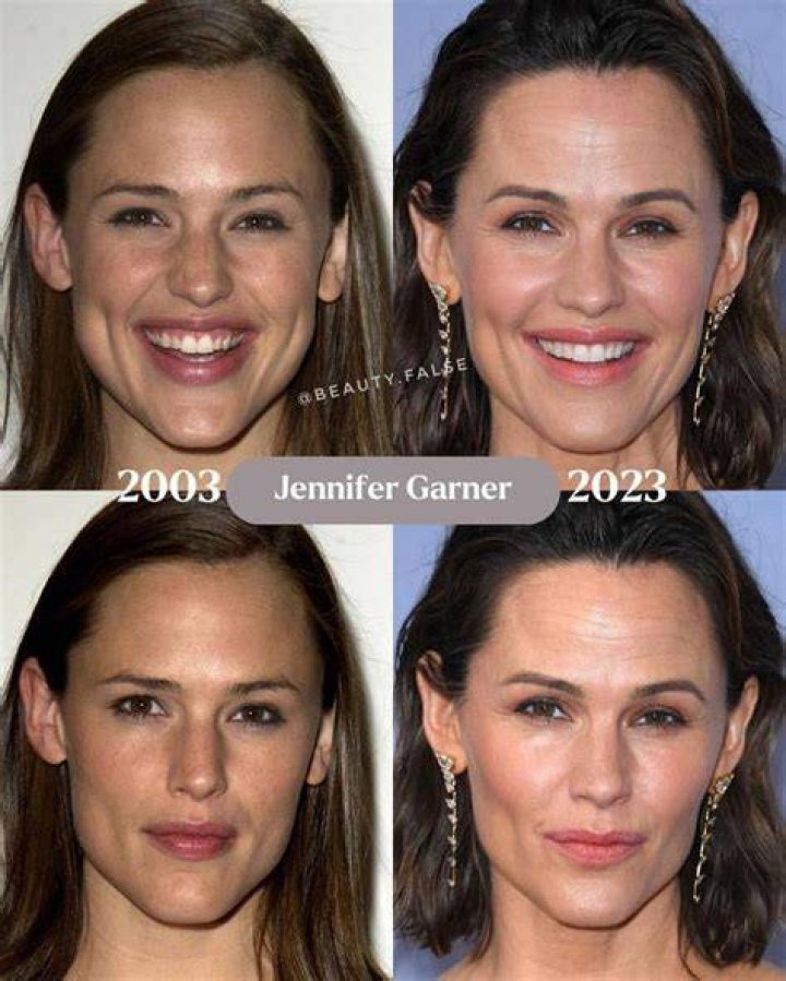 Jennifer Garner Swears Off Plastic Surgery — She’s The Real Deal