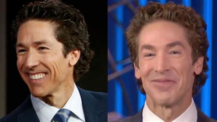 Joel Olsteen Plastic Surgery: Everything You Need to Know About His Surgery