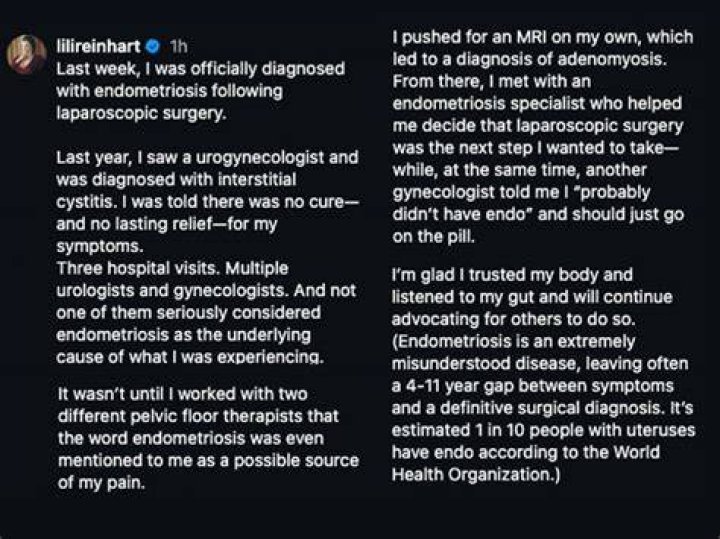 Olivia Culpo Undergoes Endometriosis Surgery And Opens Up About The ‘Agony’ She’s Been Through For Years!