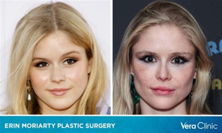 Olivia Jade Plastic Surgery: Olivia's Plastic Surgery Rumors Explored!