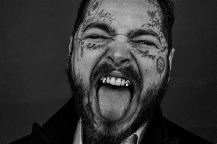Post Malone Gets Diamond Fangs And Now He Literally Has A $1 Million Smile – Pic!