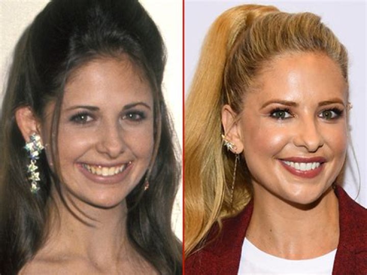 Sarah Michelle Gellar Plastic Surgery Before and After