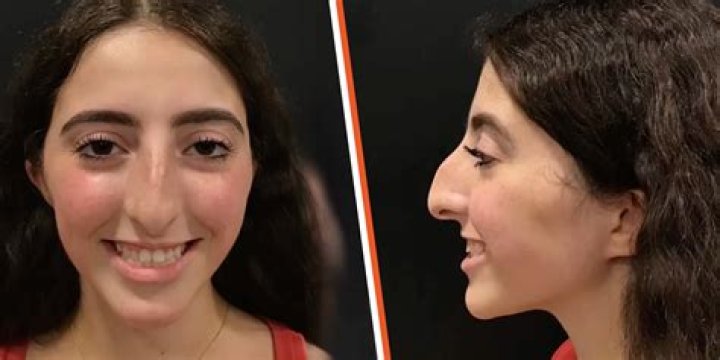 Top 5 Lia Thomas before and after photos