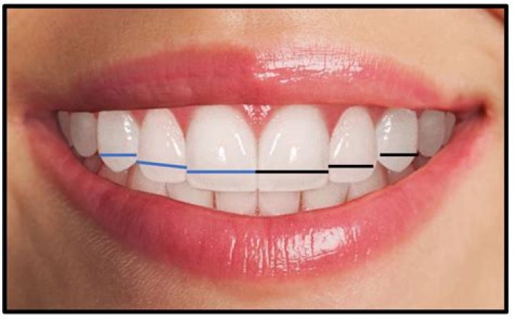 Was Dr. Teeth based on Dr John? – Celebrity