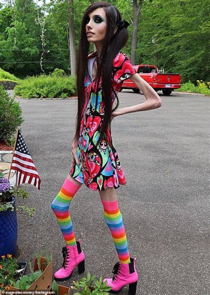 What disease does Eugenia Cooney have? Eating disorder explained
