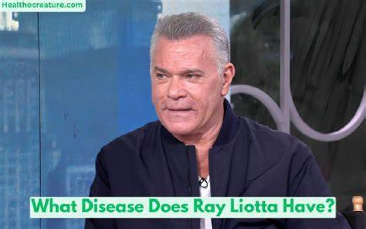 What disease does Ray Liotta have? Ray Liotta illness explained