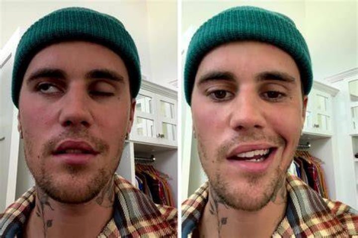 What happened to Justin Bieber?