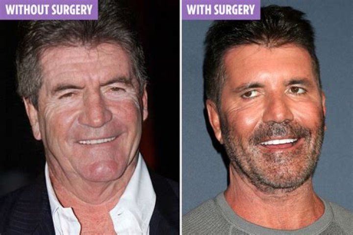 What is Simon Cowell worth? – Celebrity