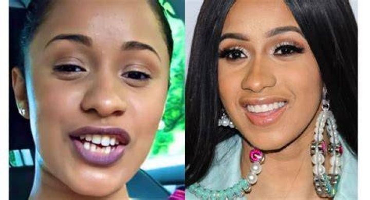 Where Did Cardi B Get Her Teeth Done At? – Celebrity