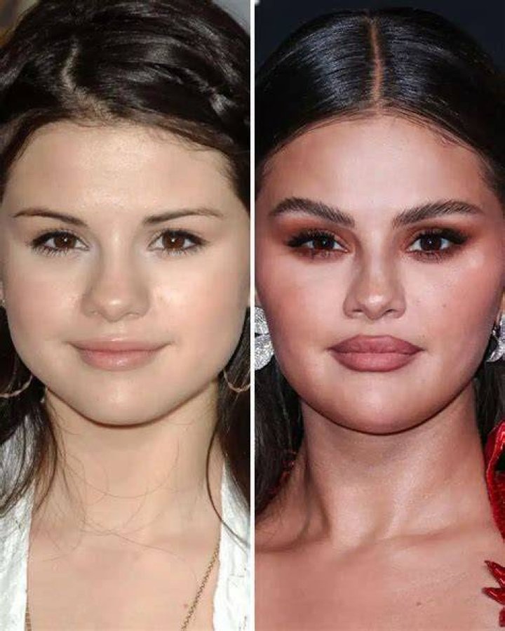 Why did Selena Gomez voice change? What type of voice does Selena Gomez have?