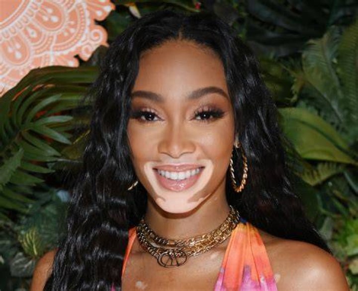 Winnie Harlow in Bathing Suit is "Glowy" — Celebwell