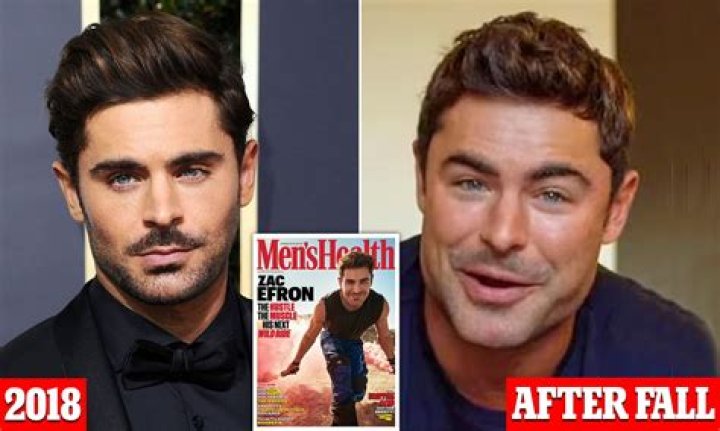 Zac Efron Rushed To The Hospital And Undergoes Surgery – Details!